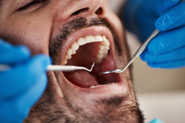 Best Emergency Dental Care for Broken or Chipped Teeth in Coshocton, OH